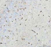 IHC staining of FFPE mouse brain tissue with Aquaporin 4 antibody. HIER: boil tissue sections in pH8 EDTA for 20 min and allow to cool before testing.