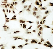 ICC testing of NRF1 antibody and A549 cells