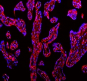 Immunofluorescent staining of FFPE human placental tissue with CD31 antibody (green) and DAPI nuclear stain (blue). HIER: steam section in pH8 EDTA buffer for 20 min.