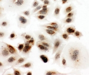 ICC testing of VASA antibody and MCF-7 cell