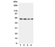Western blot testing of LCAT antibody and Lane 1:  rat brain;  2: U87;  3: HeLa;  4: SMMC-7721 cell lysate.  Observed size 50~75KD, depending on glycosylation level.