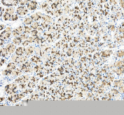 IHC staining of FFPE human stomach tissue with TJP2 antibody, HRP-secondary and DAB substrate. HIER: boil tissue sections in pH8 EDTA for 20 min and allow to cool before testing.
