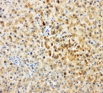 IHC-P: Tec antibody testing of rat liver tissue