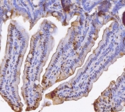 IHC staining of FFPE mouse colon tissue with Bid antibody. HIER: boil tissue sections in pH8 EDTA for 20 min and allow to cool before testing.