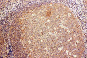 IHC staining of FFPE human tonsil tissue with CD68 antibody, HRP-labeled secondary and DAB substrate. HIER: boil tissue sections in pH8 EDTA for 20 min and allow to cool before testing.