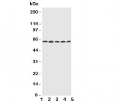 Western blot testing of CYP2U1 antibody and Lane 1:  HeLa;  2: MCF-7;  3: MM453;  4: COLO320;  5: HT1080 cell lysate