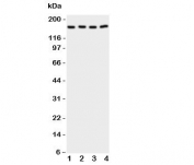 Western blot testing of cPLA2 antibody and Lane 1:  rat testis;  2: (r) brain;  3: human A549;  4: (h) COLO320 cell lysate.  Expected size 85~110KD, observed here at ~160KD