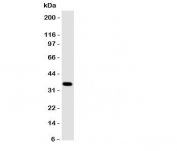 Western blot testing of Annexin A10 antibody and A549 cell lysate. Predicted molecular weight: ~36kDa.
