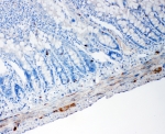IHC staining of FFPE rat intestine tissue with Proprotein Convertase 1/3 antibody. HIER: boil tissue sections in pH6, 10mM citrate buffer, for 10-20 min and allow to cool before testing.