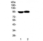 Western blot testing of Prolactin Receptor antibody and Lane 1:  human HeLa;  2: human MCF-7 cell lysate. Expected molecular weight: 70-117 kDa depending on glycosylation level.