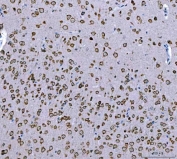 IHC staining of FFPE mouse brain tissue with Ataxin-2 antibody. HIER: boil tissue sections in pH8 EDTA for 20 min and allow to cool before testing.