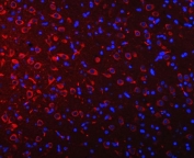 Immunofluorescent staining of FFPE rat brain tissue with Ataxin-2 antibody (red) and DAPI nuclear stain (blue). HIER: steam section in pH8 EDTA buffer for 20 min.
