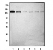 Western blot testing of 1) human K562, 2) human A549, 3) rat brain, 4) rat liver, 5) mouse brain and 6) mouse liver tissue lysate with Ataxin-2 antibody. Expected molecular weight: 114~140 kDa.