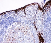 IHC-P: Cystatin A antibody testing of human tonsil tissue