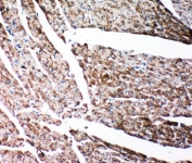 IHC-P: Gelsolin antibody testing of rat heart tissue. HIER: steamed with pH6 citrate buffer.