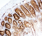 IHC-F testing of VCP antibody and rat intestine tissue