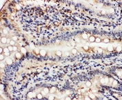 IHC-P: VCP antibody testing of rat intestine tissue