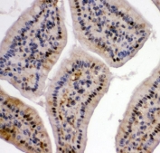 IHC-P: VCP antibody testing of mouse intestine tissue