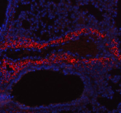 Immunofluorescent staining of FFPE mouse lung tissue with Collagen 1 antibody (red) and DAPI counterstain (blue). HIER: boil tissue sections in pH8 EDTA buffer, for 10-20 min and allow to cool before testing.