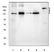 Western blot testing of 1) human placenta, 2) rat skin, 3) rat lung, 4) mouse skin and 5) mouse NIH 3T3 cell lysate with Collagen 1 antibody. Expected molecular weight: 140-210 kDa (precusor), 70-90 kDa (mature).
