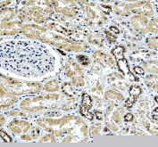 IHC staining of FFPE human kidney tissue with NKCC2 antibody, HRP-secondary and DAB substrate. HIER: boil tissue sections in pH8 EDTA for 20 min and allow to cool before testing.