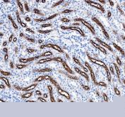IHC staining of FFPE rat kidney tissue with NKCC2 antibody, HRP-secondary and DAB substrate. HIER: boil tissue sections in pH8 EDTA for 20 min and allow to cool before testing.