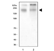Western blot testing of 1) rat kidney and 2) mouse kidney tissue lysate with NKCC2 antibody.  Predicted molecular weight ~121 kDa but may be observed at higher molecular weights due to glycosylation.