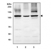 Western blot testing of 1) rat brain, 2) rat C6 and 3) mouse brain tissue lysate with SLC12A6 antibody.  Expected molecular weight ~128 kDa.