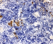 IHC-P: Leupaxin antibody testing of rat spleen tissue