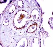 IHC-P: ACE antibody testing of human placenta tissue