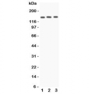 Western blot testing of Angiotensin Converting Enzyme antibody and Lane 1:  A549;  2: HeLa;  3: 22RV1 lysate.  Expected molecular weight 140-170 kDa.