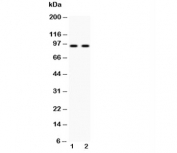 Western blot testing of Cadherin 17 antibody and 1) human HeLa and 2) human SW620 cell lysate. Predicted molecular weight ~92 kDa but may be observed at higher molecular weights due to glycosylation.