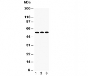 Western blot testing of KLF4 antibody and Lane 1:  HeLa;  2: A549;  3: U20S cell lysate. Predicted molecular weight: 50-60 kDa + possible ~75 kDa (phosphorylated form).