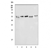 Western blot testing of 1) human PANC-1, 2) human HT1080, 3) human U-251, 4) rat C6 and 5) mouse testis tissue lysate with ATG5 antibody. Predicted molecular weight ATG5: ~32 kDa; ATG5/ATG12 heterodimer: ~56 kDa.
