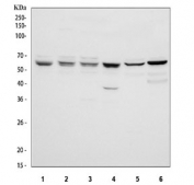 Western blot testing of 1) human 293T, 2) human HeLa, 3) human MCF7, 4) human HepG2, 5) rat testis and 6) rat C6 cell lysate with PRMT4 antibody. Predicted molecular weight ~66 kDa.