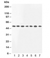 Western blot testing of MEK2 antibody and Lane 1: rat skeletal muscle;  2: rat kidney; and human samples 3: HeLa;  4: COLO320;  5: PC12;  6: Jurkat;  7: HT1080 lysate.  Observed molecular weight ~50kDa.