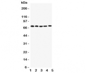 Western blot testing of Kv1.4 antibody and Lane 1:  rat brain;  2: human HY1080;  3: (h) PANC;  4: (h) U87;  5: (h) SHG-44 lysate