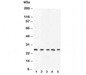 Western blot testing of TNFa antibody and rat samples:  1. PC-12, 2. spleen, 3. brain, 4. kidney, 5. liver lysate. Predicted/observed molecular weight: ~26 kDa.