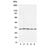 Western blot testing of Adiponectin antibody and rat samples 1:  testis;  2: spleen;  3: skeletal muscle;  4: heart;  5: liver lysate. Routinely observed at 26~30kDa.
