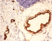 IHC-P testing of rat lung tissue. HIER: steamed with pH6 citrate buffer.