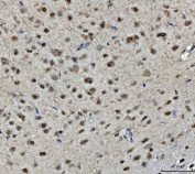 IHC staining of FFPE rat brain tissue with BRCA1 antibody. HIER: boil tissue sections in pH8 EDTA for 20 min and allow to cool before testing.