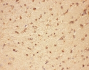 IHC-P: CNTF antibody testing of mouse brain tissue