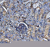 IHC staining of FFPE rat kidney tissue with Annexin V antibody, HRP-labeled secondary and DAB substrate. HIER: boil tissue sections in pH8 EDTA for 20 min and allow to cool before testing.