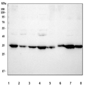 Western blot testing of 1) human HeLa, 2) human K562, 3) human 293T, 4) human HepG2, 5) rat heart, 6) mouse heart, 7) mouse RAW264.7 and 8) mouse NIH 3T3 cell lysate with Annexin V antibody. Predicted molecular weight ~36 kDa.