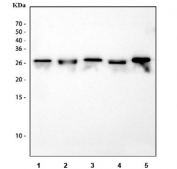 Western blot testing of 1) human K562, 2) rat kidney, 3) rat brain, 4) mouse kidney and 5) mouse brain tissue lysate with Calbindin antibody.  Expected molecular weight: 24-30 kDa (two isoforms).