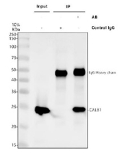 Immunoprecipitation of Calbindin protein from 500ug of human K562 whole cell lysate with 2ug of Calbindin antibody.
