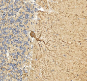 IHC staining of FFPE human cerebellum tissue with Calbindin antibody. HIER: boil tissue sections in pH8 EDTA for 20 min and allow to cool before testing.