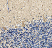 IHC staining of FFPE human cerebellum tissue with Calbindin antibody. HIER: boil tissue sections in pH8 EDTA for 20 min and allow to cool before testing.