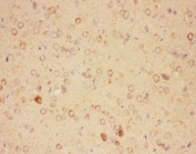 IHC-P: CNTF antibody testing of rat brain tissue