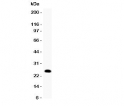 Western blot testing of GDNF antibody and rat brain lysate